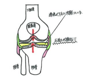 動き始めに膝が痛い！