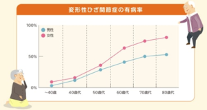 変形性膝関節症は女性の方が多い！？